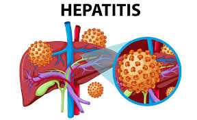 What You Should Know About Hepatitis